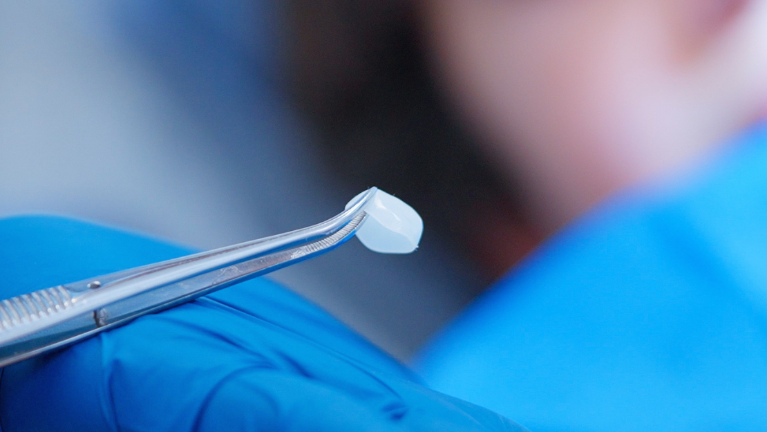 Directa Ceramir Paediatric Crowns: A new and innovative approach to restoring primary teeth
