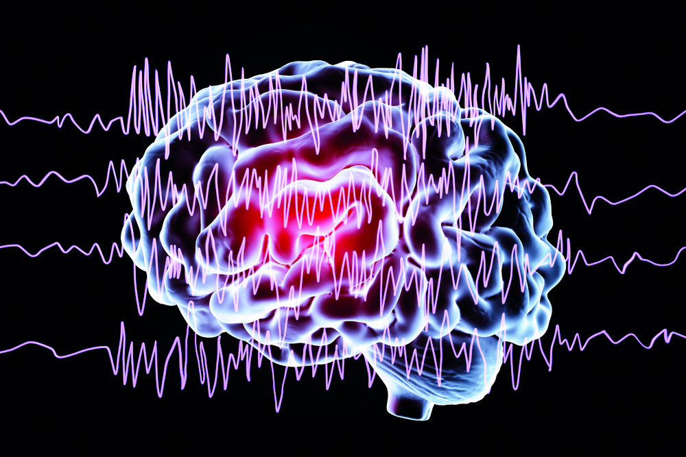 Epilepsy and dental health