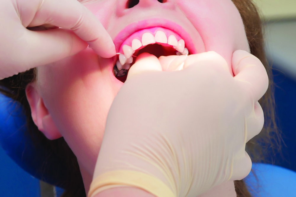 A deft touch – how does technique change oral hygiene outcomes?