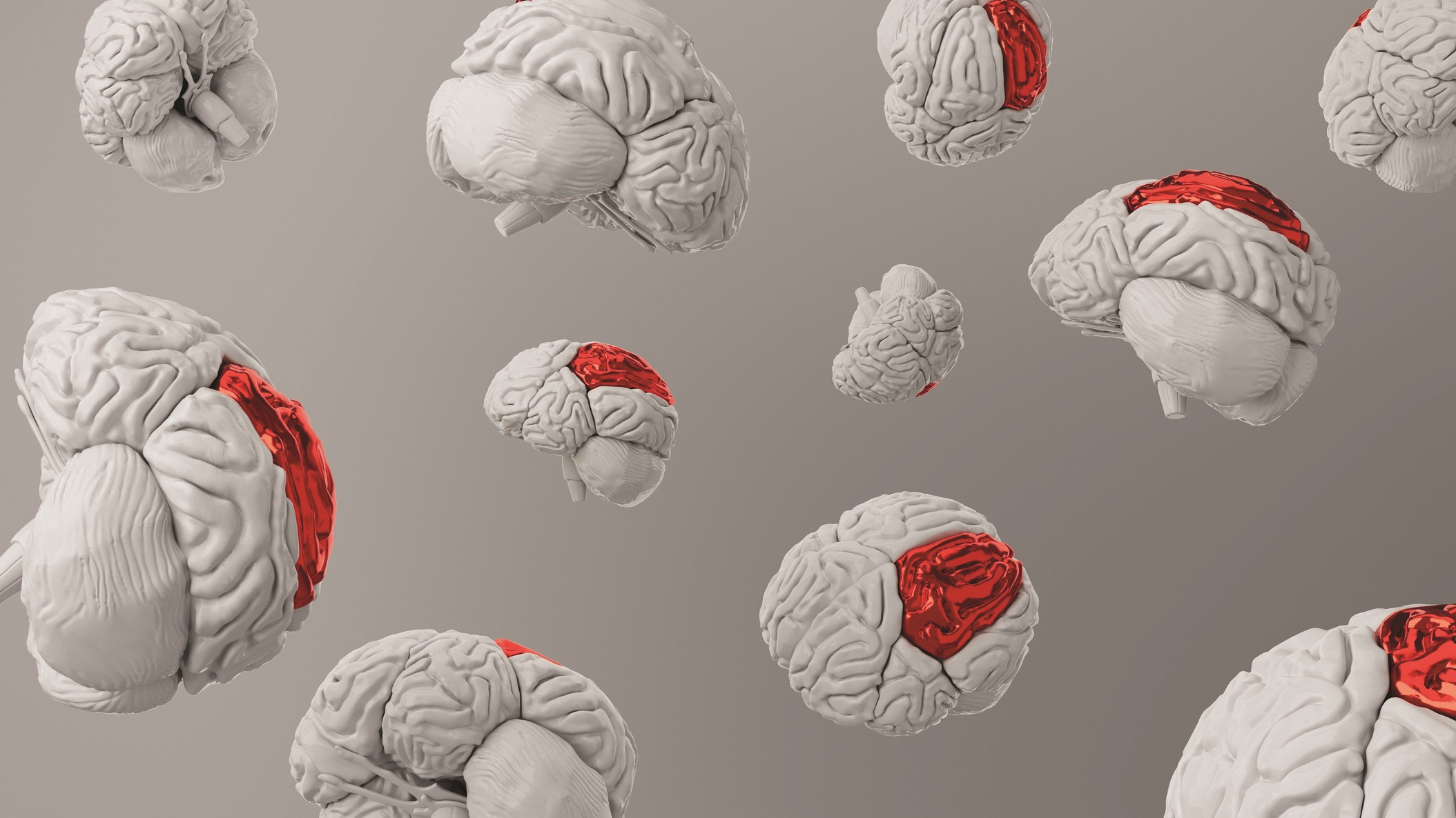 Aneurysm analysis – is there an oral health link?